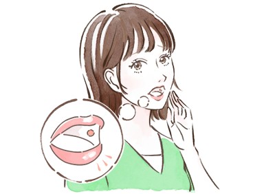 口内炎の症状・原因・対策