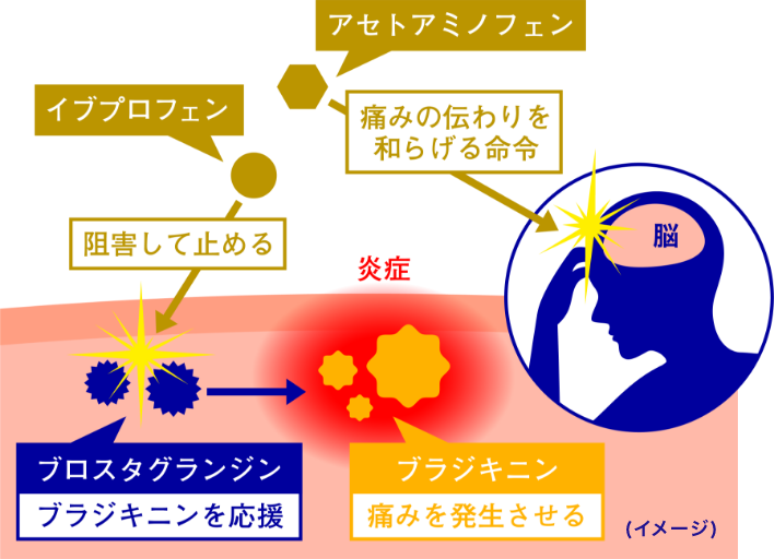 痛みが起こる原因　プロスタグランジンって？