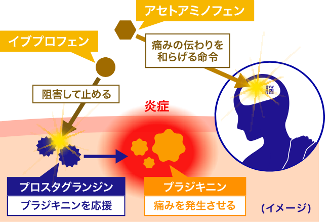 プロスタグランジンの生成を抑制する鎮痛成分を配合