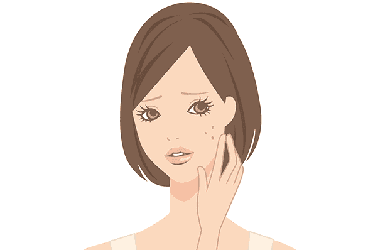 肌荒れの症状・原因・対策のイメージ